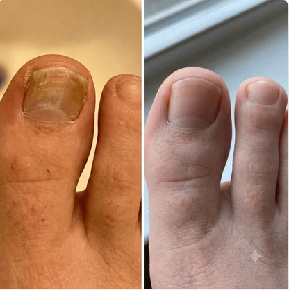 El Tratamiento Natural Nº1 para Recuperar Uñas Sanas y Fuertes
