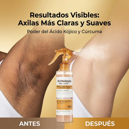 Spray Exfoliante Instantáneo - Dr. Melaxin