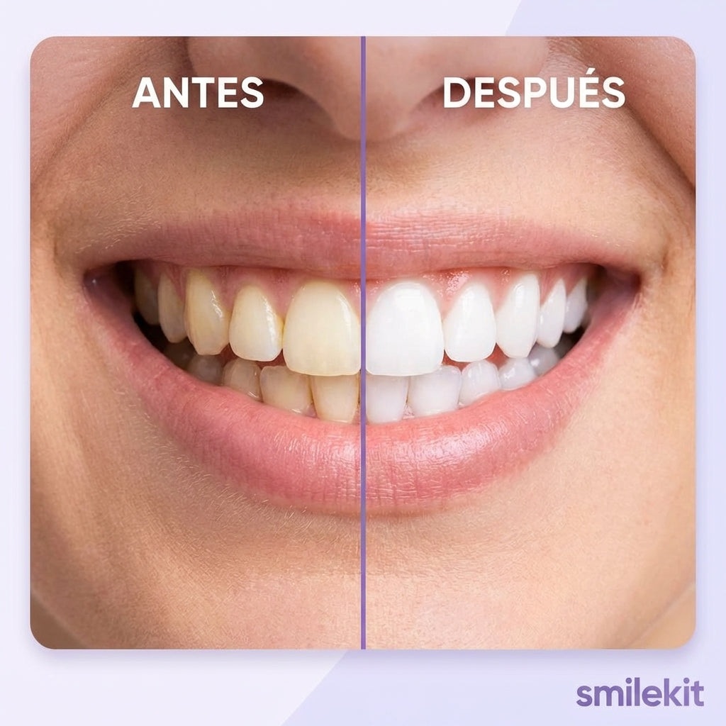 Smilekit - Tiras Blanqueadoras Dentales